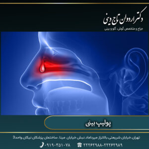 پولیپ بینی - تاج دینی