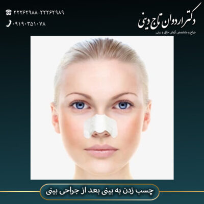 چسب زدن به بینی - دکتر اردوان تاج دینی- drtajdini.com