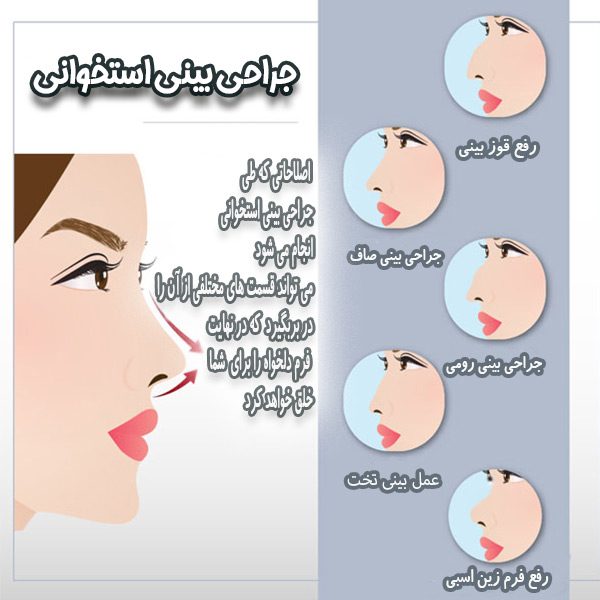 جراحی بینی استخوانی - دکتر اردوان تاج دینی-drtajdini.com