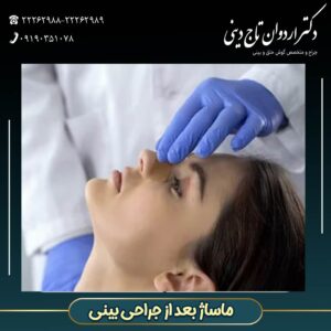 ماساژ بعد از جراحی بینی - دکتر اردوان تاج دینی-drtajdini.com