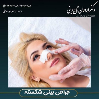 جراحی بینی شکسته - drtajdini.com