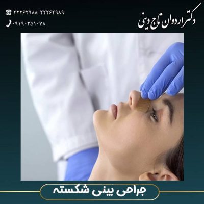 بینی شکسته - drtajdini.com