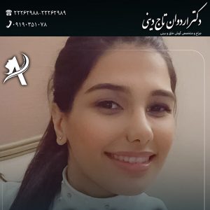 جراجی بینی نیمه فانتزی 2- دکتر اردوان تاج دینی