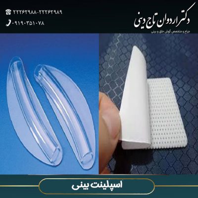 اسپلینت بینی - دکتر اردوان تاج دینی -drtajdini.com