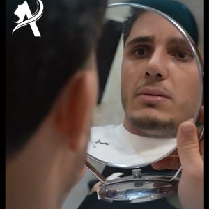 عکس عمل بینی مردانه گوشتی- دکتر تاجدینی-drtajdini.com