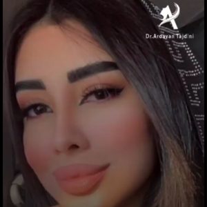 جراحی بینی طبیعی - دکتر تاج دینی -drtajdini.com