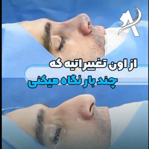 عکس عمل بینی کج - دکتر تاج دینی - drtajdini.com