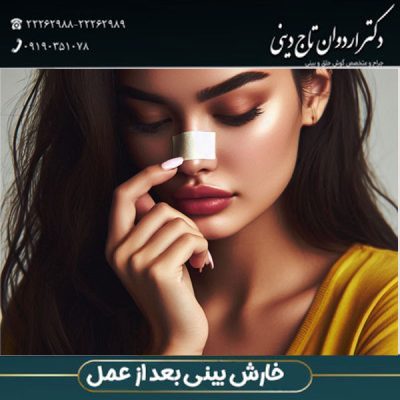 خارش بعد از عمل بینی - دکتر تاج دینی - drtajdini.com