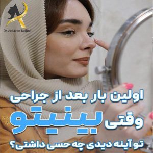 جراحی بینی به روش باز - دکتر ارداون تاج دینی - drtajdini.com