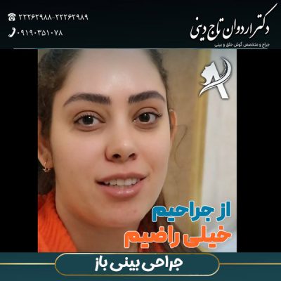 جراحی بینی باز - دکتر اردوان تاج دینی