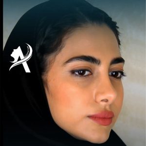 عکس جراحی بینی نچرال - دکتر تاج دینی - drtajdini.com