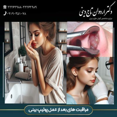 مراقبت های بعد از عمل پولیپ بینی - دکتر اردوان تاج دینی -drtajdini.com