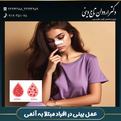 عمل بینی در افراد مبتلا به آنمی - دکتر تاج دینی -drtajdini.com