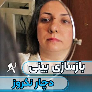 عکس نمونه جرحی بینی ترمیمی - دکتر تاج دینی -drtajdini.com