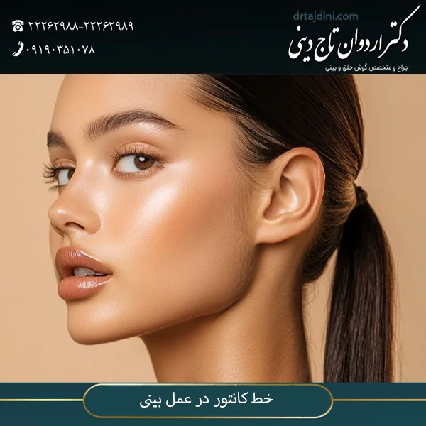 خط کانتور در عمل بینی - دکتر تاج دینی
